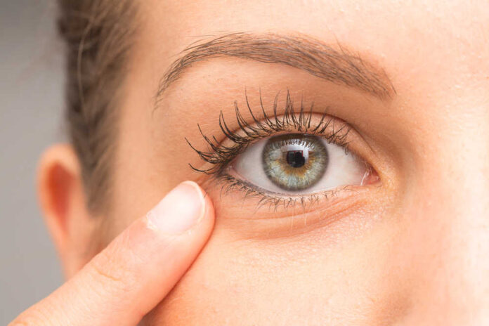 Female,Pointing,Eye,Bag,With,Finger