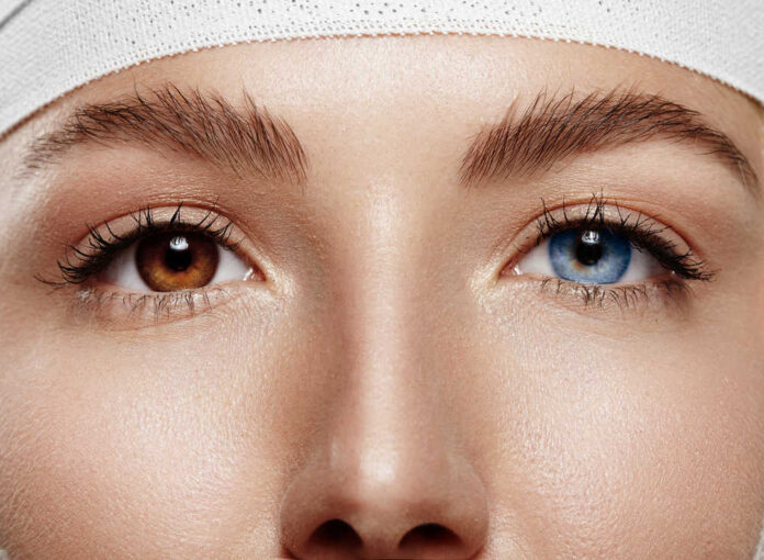 Pretty,Woman's,Eyes,Have,A,Different,Color