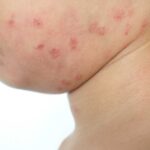 Your Skin Barrier Is NOT About Beauty