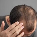 We Were WRONG About That Hair-Loss Pill